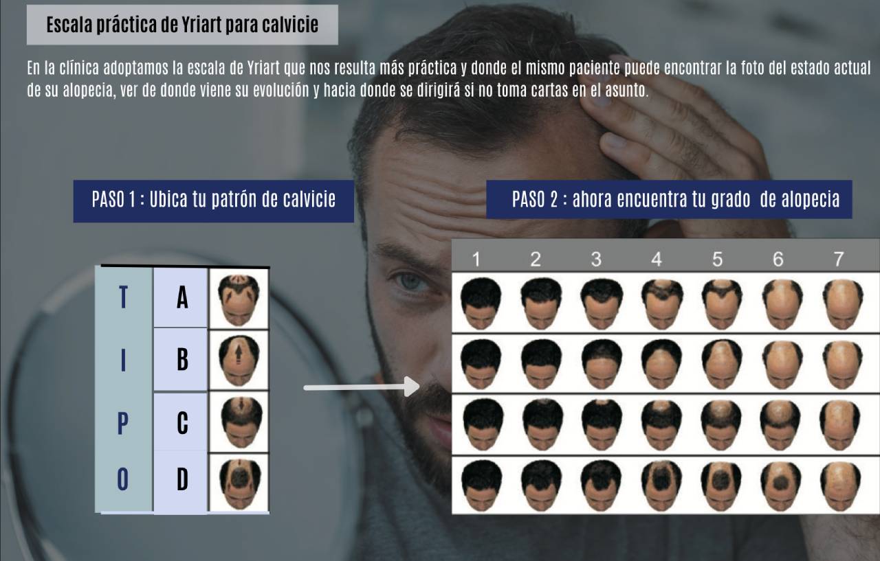 Escala Yriart para la clasificación de la alopecia